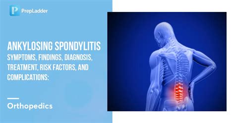 Ankylosing Spondylitis Symptoms Findings Diagnosis Treatment Risk