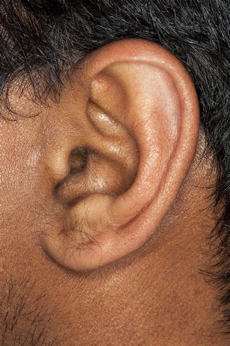 Human Ear Photograph By Science Photo Library Fine Art America