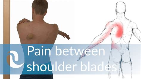 Pain In Left Breast And Shoulder Blade Scapular Shoulder Blade