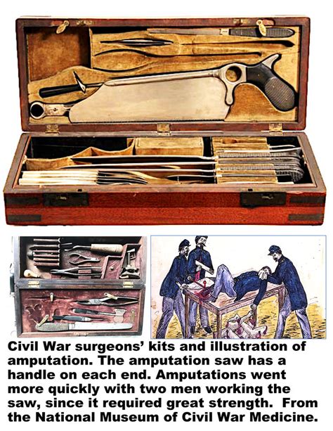 Civil War Surgery