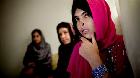 afghan woman had her nose and ears chopped off by the taliban after being forced to marry