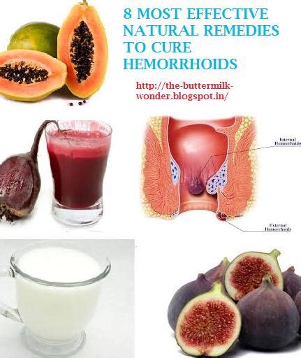 8 most effective natural remedies to treat hemorrhoids with quick results buttermilk a wonder cure