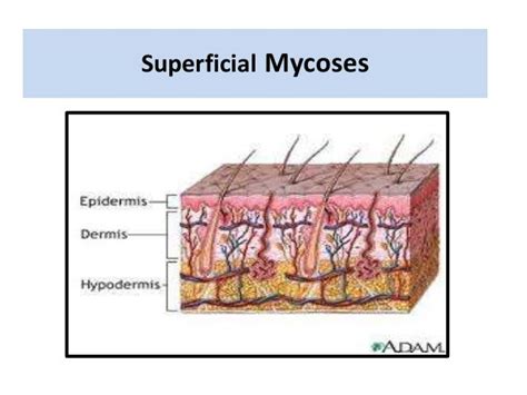 Superficial Mycoses