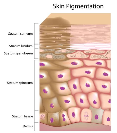Pigmentation Of The Skin That Determines Skin Color Health Care