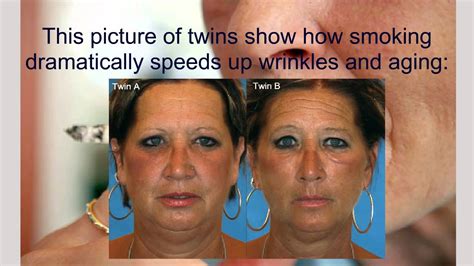 How Smoking Causes Wrinkles Youtube