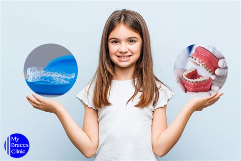 Invisalign Aligners Parents Guide To Braces For Kids