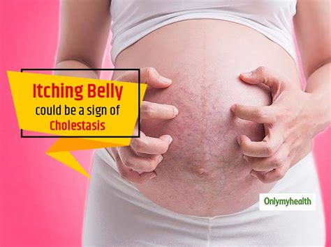 Itching and Discomfort During Pregnancy Are Signs Of ...
