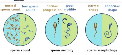 Low Sperm Count Symptoms Causes Testing And Cure Urban Verified