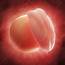 Embryo At 4 Weeks Artwork  Stock Image F005/4950 Science Photo