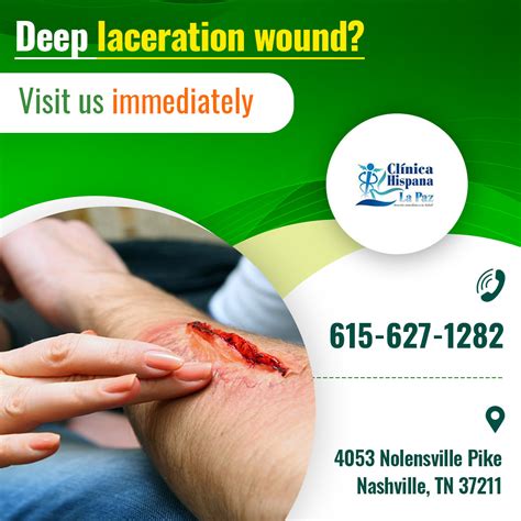 Top Ways To Manage Deep Laceration Wound You Cannot Treat Flickr