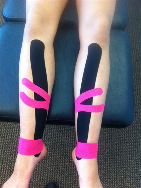 Kinesio Taping Chiropractic And Active Release Technique Dr Soroush