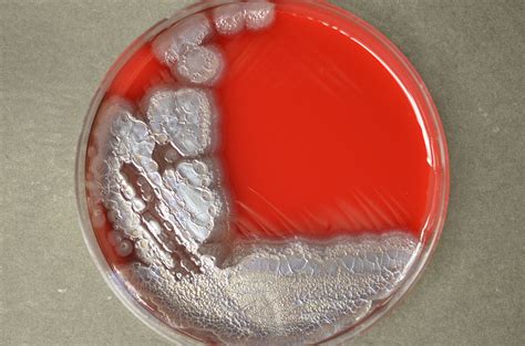 Pseudomonas Aeruginosa Is One Of The Most Distinctive Organisms In The
