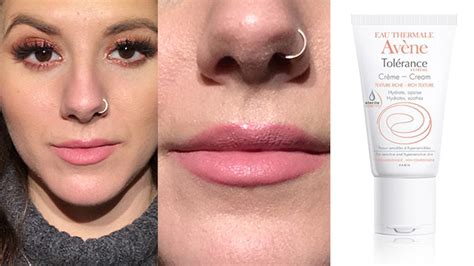 Dry Skin Above Lip How To Get Rid Of It