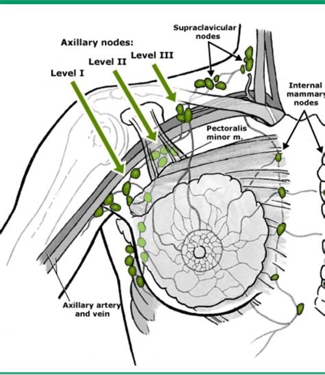 Axillary Lymph Nodes Part Deux