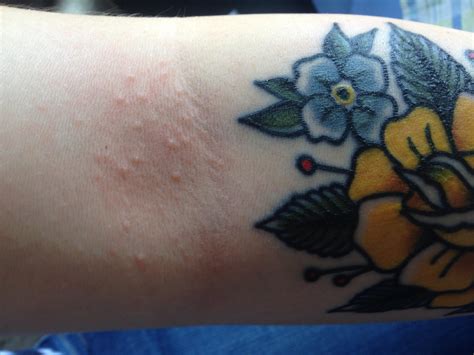 Strange Rash Above My Tattooanyone Know What It Is Pic In Comments