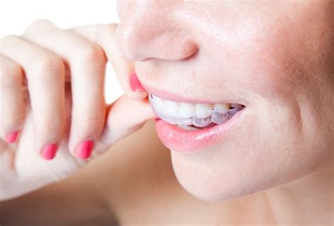 Does Invisalign Treatment Hurt Lower Mainland Bc Dentists Straight