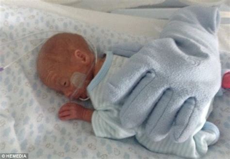 Premature Baby Born Three Months Early And Weighing Under 2lb Is Back