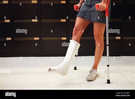 Woman Leg Cast Crutches In Hi Res Stock Photography And Images Alamy
