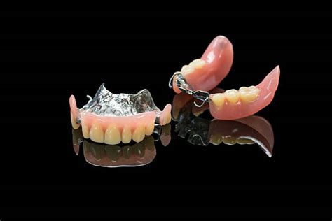 Royalty Free Partial Plate Denture Pictures Images And Stock Photos