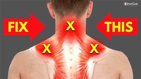 How To Fix A Sore Neck And Shoulders In Seconds Spinecare