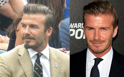 Has david beckham had a hair transplant top hair loss. The 7 Best Hairstyles For A Receding Hairline | The Bald Gent