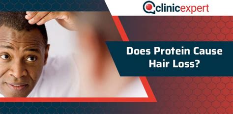 Remicade wasn't reported to cause hair loss or teeth issues. Does Protein Cause Hair Loss? | ClinicExpert
