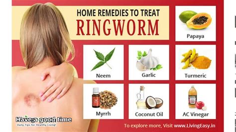 How To Treat Ringworm At Home Youtube