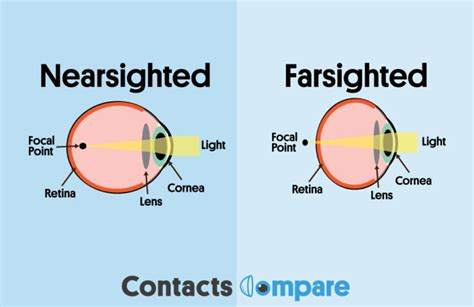 Nearsighted vs Farsighted | Contacts Compare
