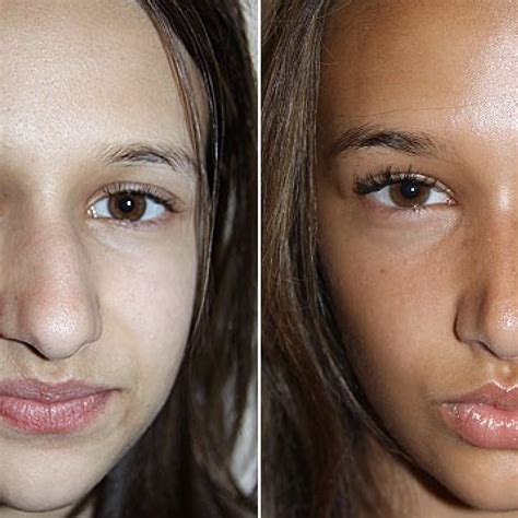 5 Telltale Signs Someone You Know Has Had A Nose Job Justinboey