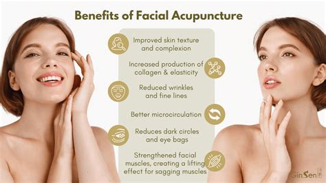 Facial Acupuncture The Benefits And How Does It Work Ginsen