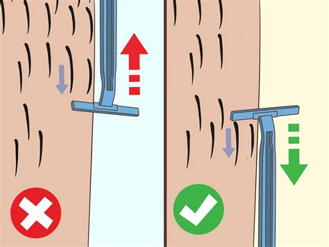 7 ways to prevent them. 3 Ways to Remove an Ingrown Hair - wikiHow