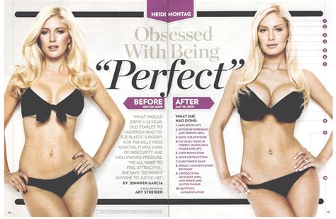 Heidi Montag S 10 Plastic Surgery Procedures Before And After Photos Huffpost