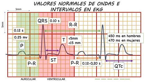 Electrocardiograma Normal GuÍa Definitiva Youtube
