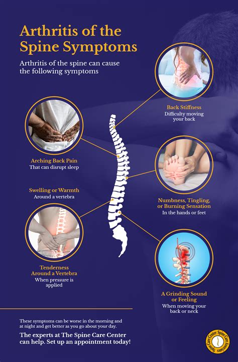 Arthritis Of The Spine Spine Arthritis Treatment In Manassas The