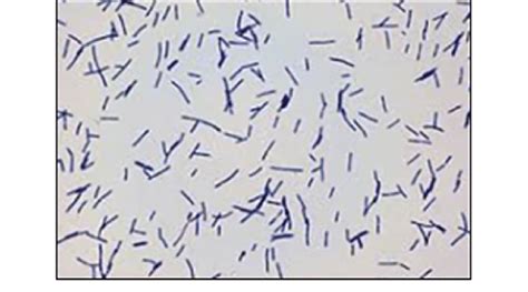 Microscopic View Of Showed Gram Positive Rod Shaped Lactobacillus