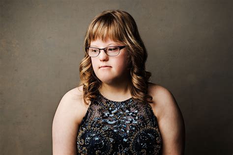 Photo Essay Challenges Down Syndrome Stereotypes Broadview Magazine