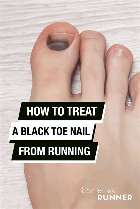 Pin By Jen Zaczyk On Other In 2020 Toe Nails Running Black Toe Nails