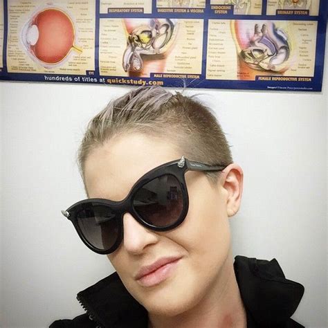 Kelly Osbourne Bit By A Venomous Spider Posts Photos In The Hospital