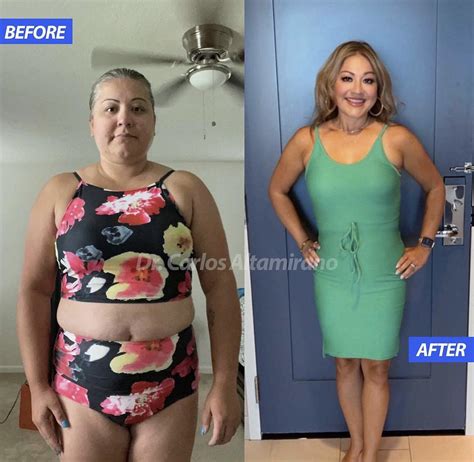 Baltic Surgery Tijuana - Bariatrics & Plastics