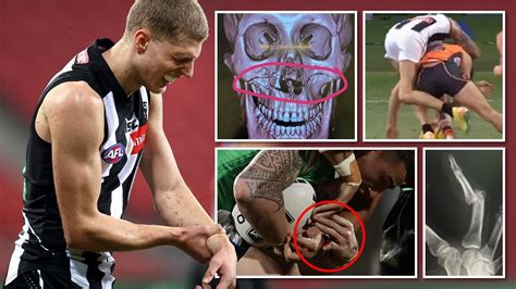 The Worst Afl And Nrl Injuries In 2020 Herald Sun