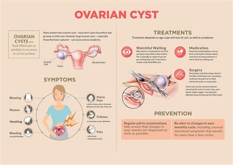 Fb Live Session Ovarian Cysts Dr Rimmy Singla Mediclinic