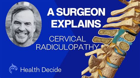 Cervical Radiculopathy Explained By Orthopedic Spine Surgeon Dr