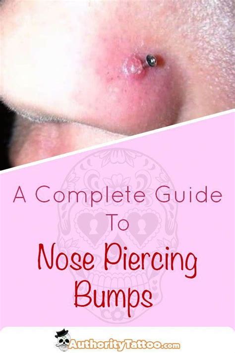 How To Get Rid Of Piercing Bump With Aspirin