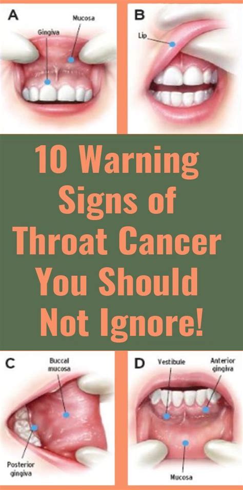 10 Warning Signs Of Throat Cancer You Should Not Ignore Healthy