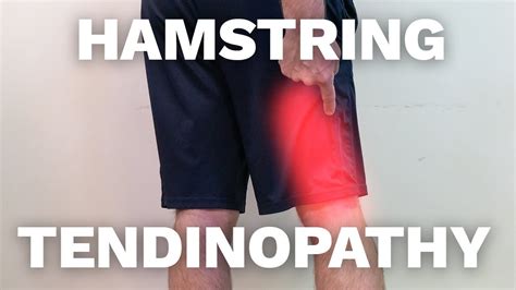 Top Exercises To Conquer Hamstring Tendinopathy Youtube