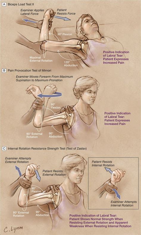 By carefully following these steps you will. Shoulder Instability or Labral Lesion?