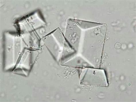 Dogs and cats are different in many ways, but both seem predisposed to urine crystal formation. Struvite crystals triple ammonium phosphate crystals ...