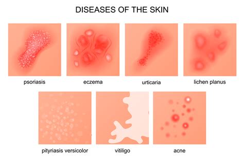Infectious Diseases Images For Presentations Coronavirus Pictures