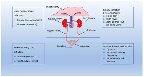 Pathogenesis Of Urinary Tract Infections Encyclopedia Mdpi
