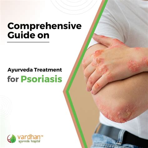 Comprehensive Guide On Ayurveda Treatment For Psoriasis Vardhan